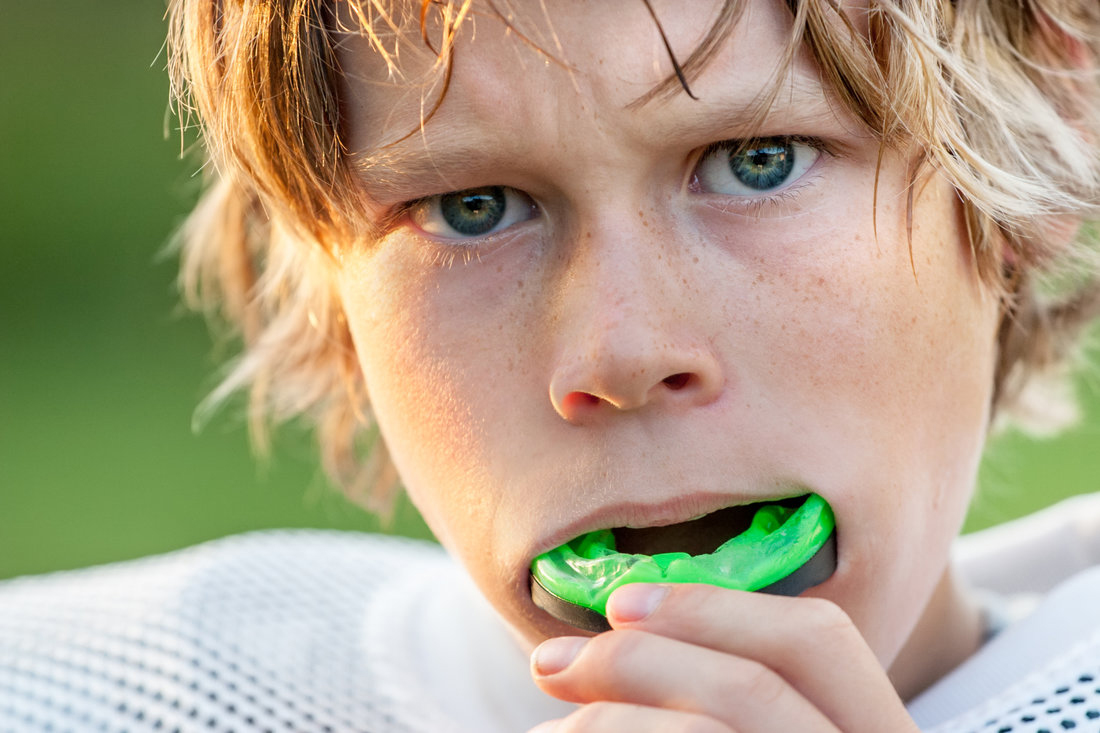 mouth-guards-and-more-clear-advantage-dental-orthodontic